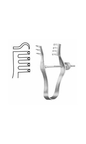 Wound Spreaders